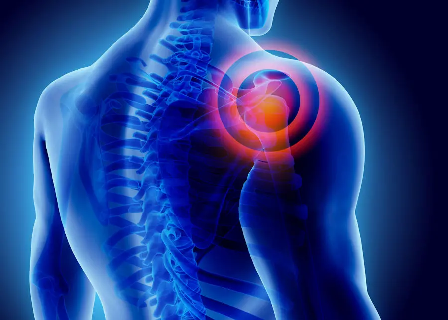 Shoulder pain graphic